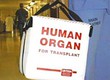 torba v kateri se prevaža darovani organ
